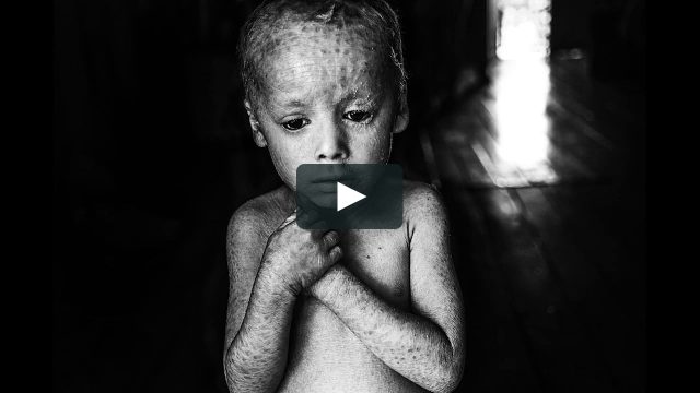 Eat up! | ARENA Documentari "Cibo Territorio Conflitto"